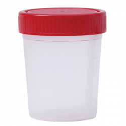 Envase muestra orina...